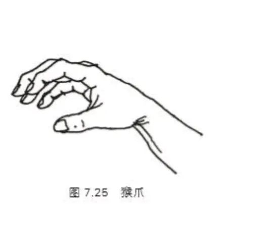 猴爪