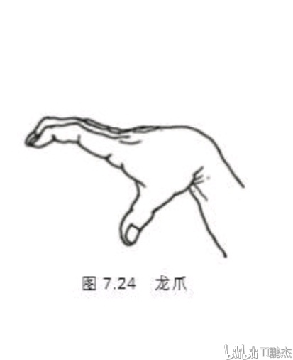龙爪